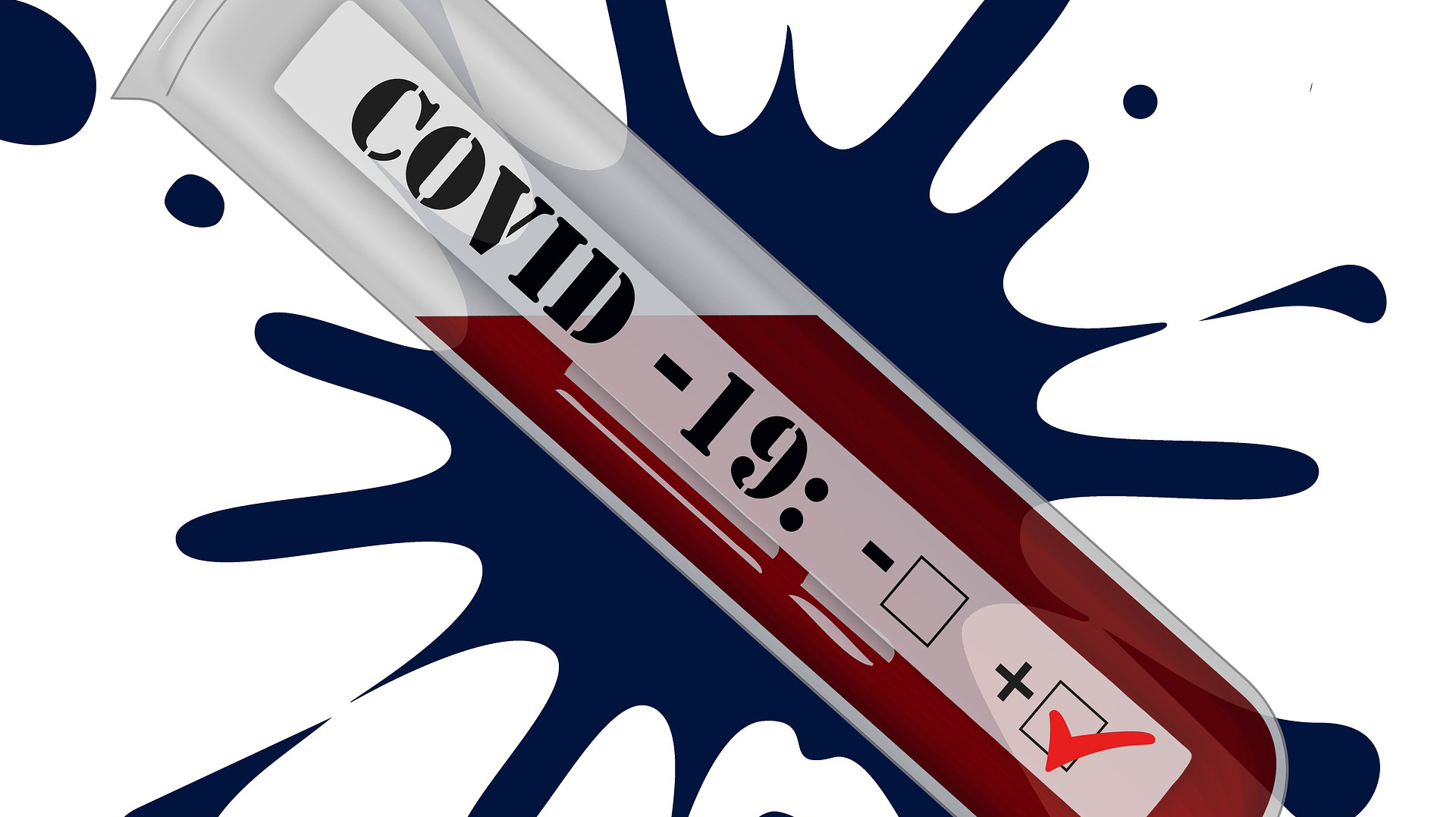 Covid 19 Test Pixabay 5675406 1920 61e187201e673